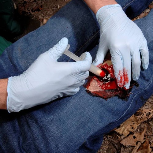 Аппликатор гемостатический с гранулами Rhino Rescue в Новокуйбышевске хитозановый